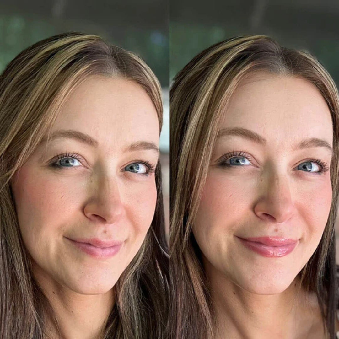 Plumpende Lippenbehandeling